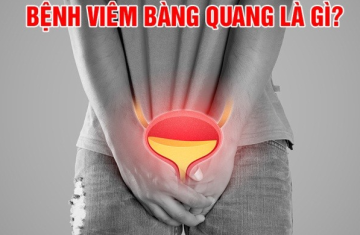 VIÊM BÀNG QUANG (P2) - LIỆU PHÁP ĐIỀU TRỊ TỪ THIÊN NHIÊN