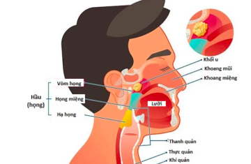 Căn bệnh ung thư đàn ông 30-50 tuổi ở Việt Nam thường gặp